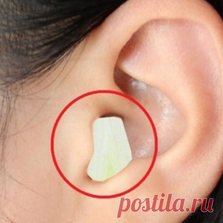 Вот что будет, если положить в ухо чеснок. Этот способ спас меня от беды!