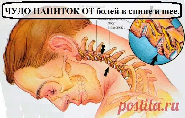 Всё самое интересное!: ЧУДО НАПИТОК ОТ болей в спине и шее.