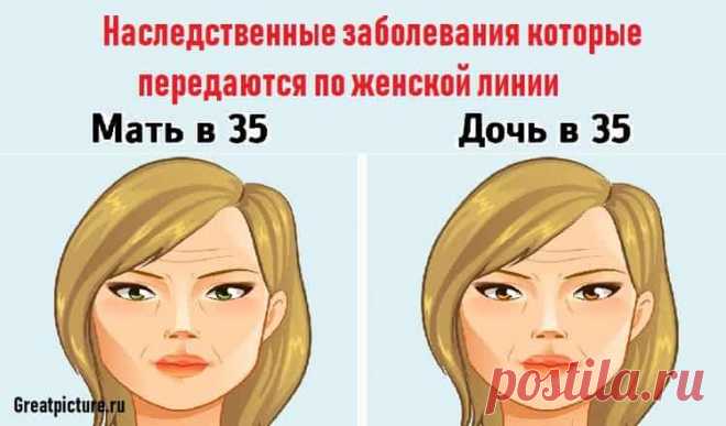 Наследственные заболевания которые передаются по женской линии 

Наследственные заболевания которые передаются по женской линии.Наши гены определяют не только внешний вид и черты характера, но и слабые места в организме. Например, даже депрессия и бессонница могу…