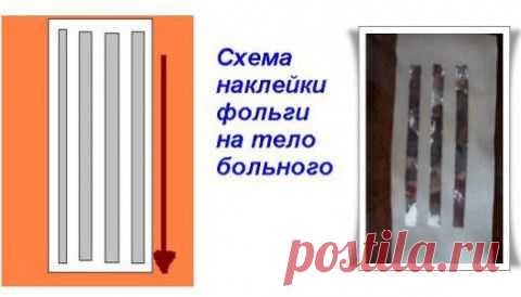 КАК С ПОМОЩЬЮ ПИЩЕВОЙ ФОЛЬГИ СНЯТЬ ЛЮБУЮ БОЛЬ - попробуйте