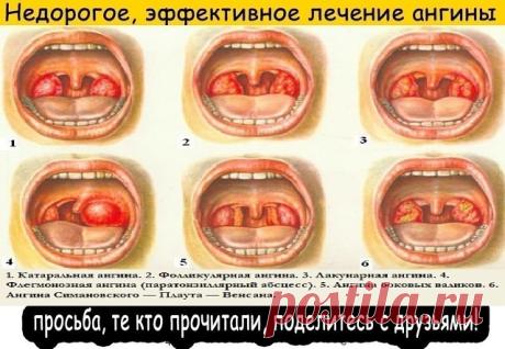 (7) Одноклассники