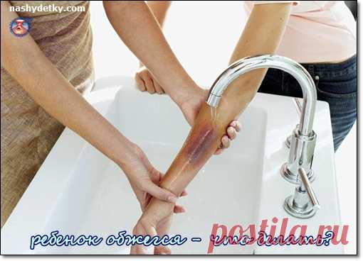 Ожоги у детей. Ребенок обжегся - что делать?