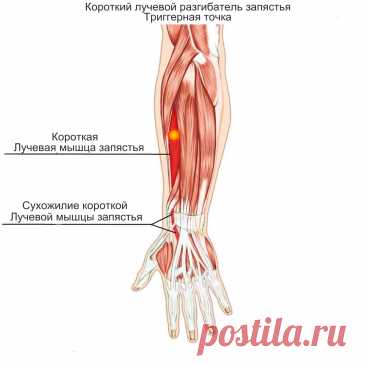 Лучевая мышца запястья. Самомассаж
