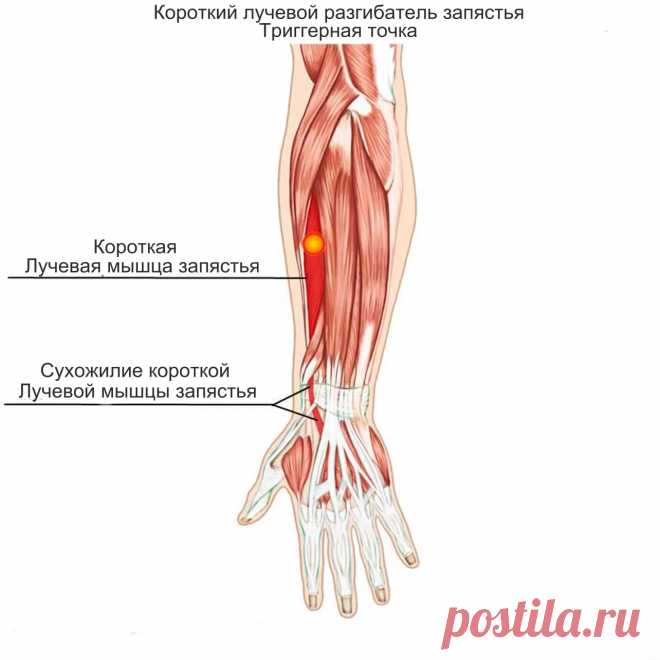 Лучевая мышца запястья. Самомассаж