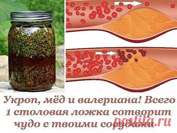 Укроп, мёд и валериана! Всего 1 столовая ложка сотворит чудо с твоими сосудами.

К сожалению, наши кровеносные сосуды имеют свойство загрязняться. Они накапливают на своих стенках отложения неорганических солей, что в дальнейшем является причиной развития атеросклероза, нарушения кровообращения, повышенного давления и варикоза.

Поэтому рекомендуется регулярно проводить курс очищения кровеносной системы. Сегодня наша редакция поделится с тобой проверенным методом очищения ...