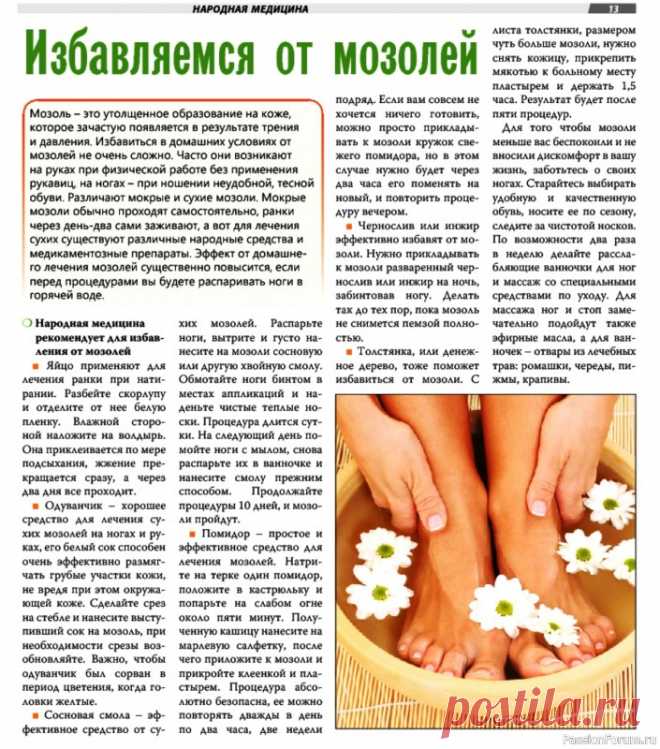 Избавляемся от мозолей народными средствами .