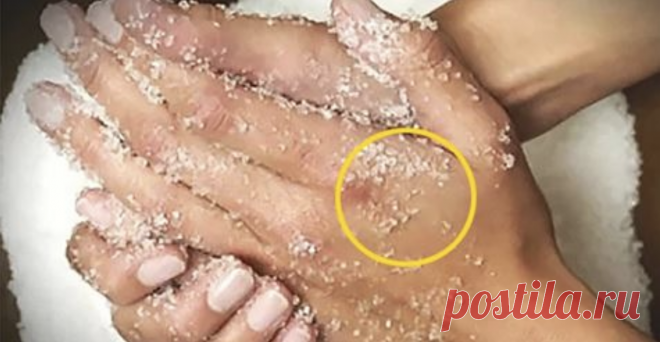 Секретный рецепт молодости для гладкости ваших рук - Ok’ейно 5 Домашних омолаживающих средств + Видео