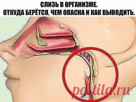 КАК ВЫВЕСТИ СЛИЗЬ ИЗ ОРГАНИЗМА И СТАТЬ ЗДОРОВЕЕ НА 10 ЛЕТ. Т
Избыточное образование слизи в организме — причина многих заболеваний и воспалительных процессов. Когда мы съедаем вареную, обработанную пищу, образуется слизь. С годами она накапливается, и если тело не справляется со своевременным очищением, слизь начинает заполнять все полости нашего тела. В первую очередь страдают легкие, бронхи, желудок. Когда её собирается много, слизь поднимается наверх и выходит через нос.
Частые простудные и и
