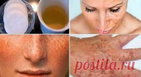 Как удалить темные пятна на лице и руках мгновенно, всего за одну ночь — Лайм