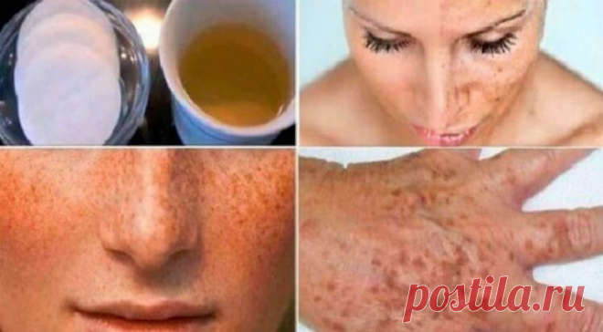 Как удалить темные пятна на лице и руках мгновенно, всего за одну ночь — Лайм