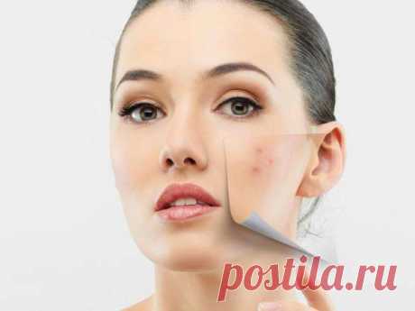 Эффективно убираем шрамы от прыщей.