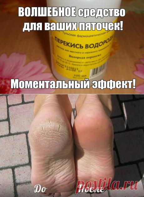 ВОЛШЕБНОЕ средство для ваших пяточек!