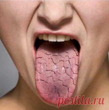 Почему появляется непривычный привкус во рту... - медиаплатформа МирТесен Если неприятный привкус во рту появляется без особой причины, это может свидетельствовать о наличии определенного заболевания. Важно разобраться, какой именно привкус вы чувствуете. Это поможет понять, в работе какого органа или системы могут быть нарушения. Безусловно, окончательный диагноз сможет
