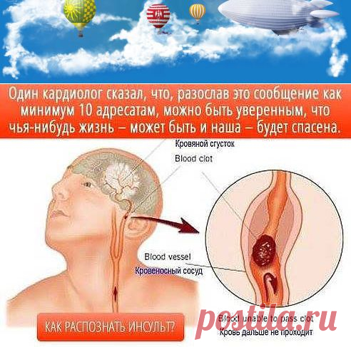 (4) Одноклассники