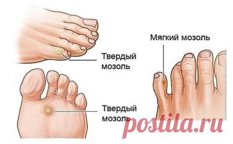 (77) Одноклассники