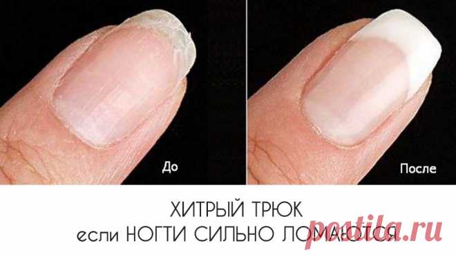 Хитрый трюк если ногти сильно ломаются Здоровые ногти прочны и эластичны, но частенько в жизни они становятся ломкими. Ведь ежедневно мы стираем, моем посуду, применяя химические средства. В результате они становятся тонкими и часто ломают…