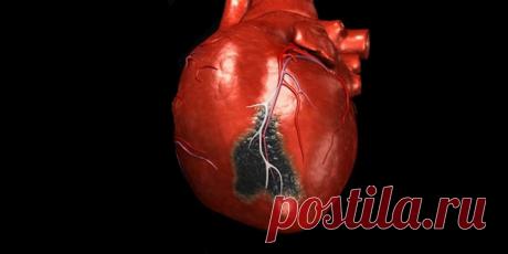 8 признаков инфаркта миокарда, при которых нужно звонить в скорую - ПолонСил.ру - социальная сеть здоровья - медиаплатформа МирТесен