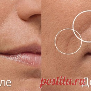 Как самостоятельно избавиться от носогубных складок. Способы на вес золота!