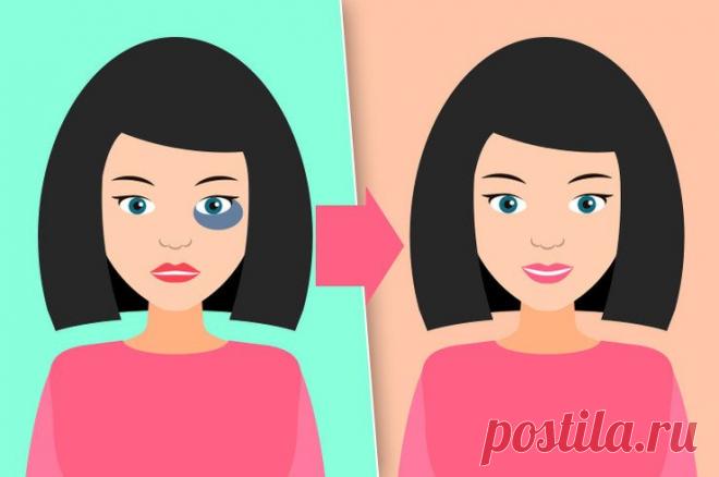 Как быстро убрать синяк на теле Хочешь надеть короткие шорты, но на колене предательски разрастается синяк. Завтра важная встреча, но вот незадача: на видном месте синеет коварное пятно. В таких ситуациях синяк не какая-то мелочь, а то, что может нарушить твои планы.