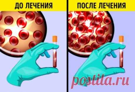 10 неочевидных причин, из-за которых постоянно хочется спать