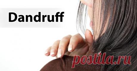 Как удалить перхоть быстро и естественно - Упражнения и похудение Вы полюбите эти средства! Перхоть — одно из самых распространенных расстройств кожи головы, от которого страдает большинство людей. Это происходит из-за воспалительного состояния кожи, среды обитания грибов и бактерий на коже головы, раздраженной жирной кожи, сухой кожи и т. д. Это приводит к тому, что ваш скальп имеет кожные чешуйки, вызывая зуд, шелушение и другие …