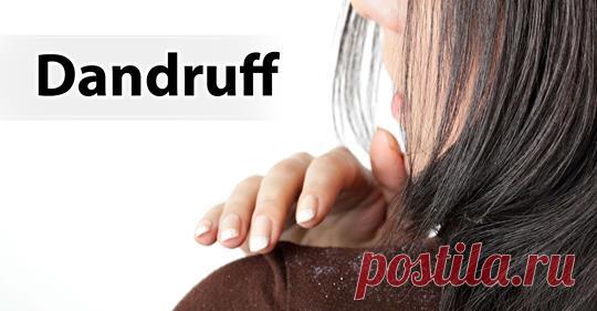 Как удалить перхоть быстро и естественно - Упражнения и похудение Вы полюбите эти средства! Перхоть — одно из самых распространенных расстройств кожи головы, от которого страдает большинство людей. Это происходит из-за воспалительного состояния кожи, среды обитания грибов и бактерий на коже головы, раздраженной жирной кожи, сухой кожи и т. д. Это приводит к тому, что ваш скальп имеет кожные чешуйки, вызывая зуд, шелушение и другие …