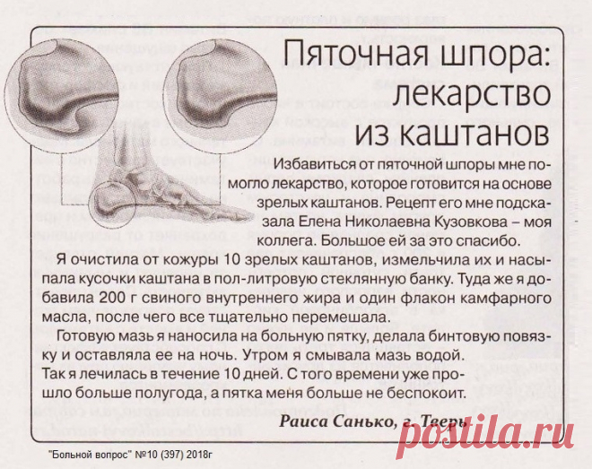 Пяточная шпора: лекарство из каштанов