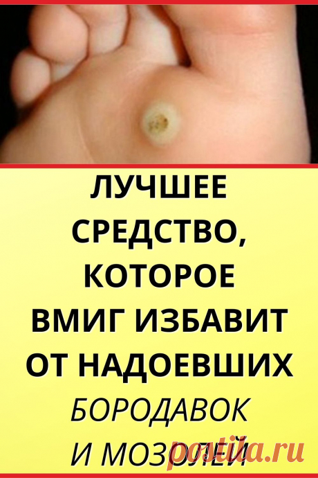 Лучшее средство, которое вмиг избавит от надоевших бородавок и мозолей
