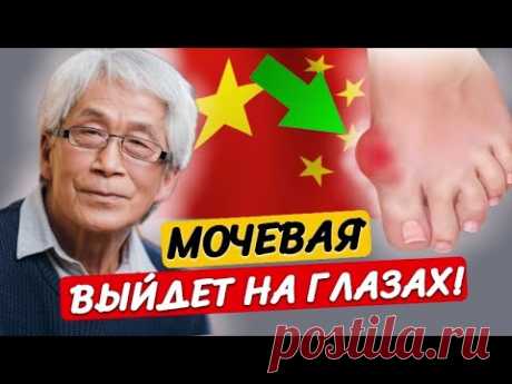 Тело само ВЫПЛЮНЕТ! Подагра боится как ОГНЯ Обычной…Китайцы так растворяют кристаллы мочевой кислоты