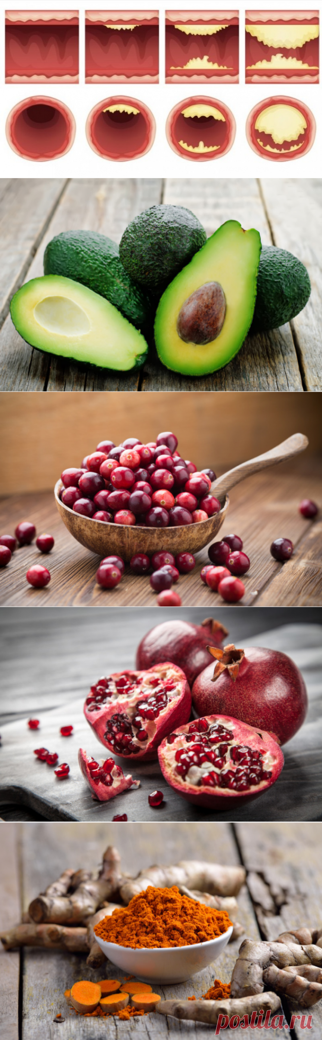 10 продуктов, которые прочистят ваши артерии и защитят от сердечного приступа - Здоровье в наших руках - медиаплатформа МирТесен