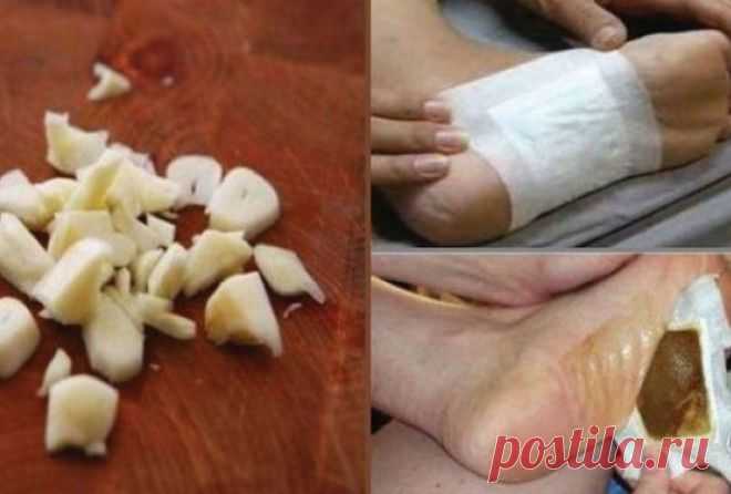 Очищение всего организма во время сна… Даже мой врач не удержался и взял рецепт!
 
Это очень простой, но невероятно эффективный метод для вывода токсинов из организма. Вывод токсинов происходит через кожу стоп во время сна. Это своего рода…