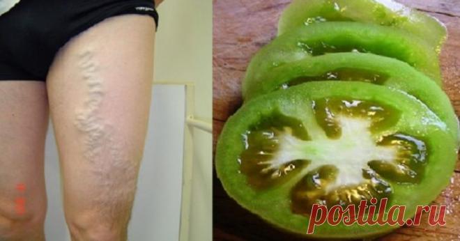 Как вылечить варикозное расширение вен с помощью помидоров 
Знаете ли вы, что вы можете вылечить ваши варикозное расширение вен с помощью помидоров?
Мы представляем вам два пути исцеления варикозного расширения вен с помощью зеленых и красных спелых томатов.
…