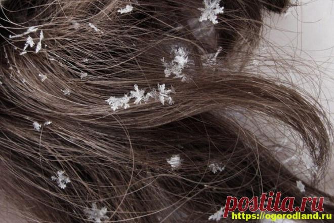 Правила ухода за волосами в зимнее время Ни для кого не секрет, что холода – враг не только для кожи, но и для волос, именно поэтом