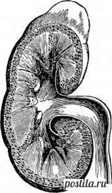 Почки отказывают: как по шести признакам это можно понять! | Сергей Витебский | Дзен