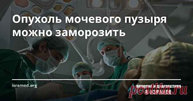 Опухоль мочевого пузыря можно заморозить По статистике 3/4 пациентов, которые страдают от злокачественных опухолей мочеполовой системы,  имеют излечимую форму немышечно-инвазивного рака мочевого пузыря (сокр. – НМИРМП). Однако проблема заключается в том, что у порядка 70 % из них происходят рецидивы данного заболевания, а после применения многих современных методов терапии состояние пациента может даже ухудшиться.