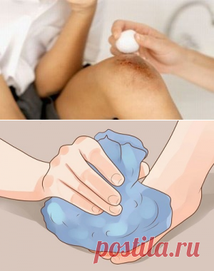 Ушибы, удары и как с ними бороться — Всегда в форме!