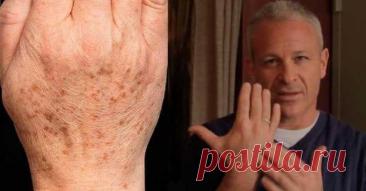 Двухкомпонентное домашнее средство от коричневых пятен на коже — Journal women❜s