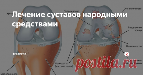 Лечение суставов народными средствами Особенно  часто напоминают о себе суставы хрустом, малоподвижностью и болью. К  процессу лечения всегда ...