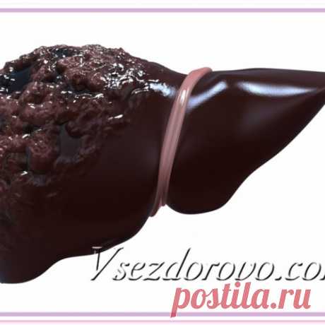 Очень простой и дешёвый способ восстановить печень. Рецепт проверен на больных циррозом печени, даже осложнённым водянкой.