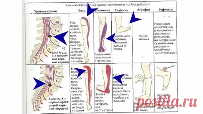 Чудо точка, которая избавит от боли в ягодице, ногах и пояснице