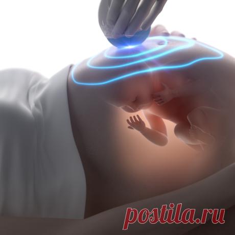 Можно ли делать ультразвуковое исследование беременным . Милая Я