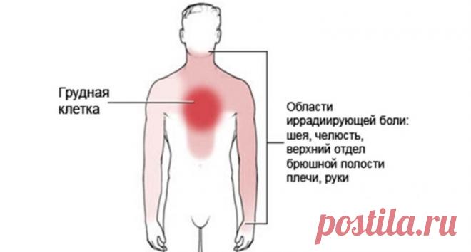 Стенокардия Принцметала (вариантная, вазоспастическая): симптомы, лечение и прогноз