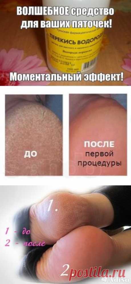 Волшебное средство для ваших пяточек.