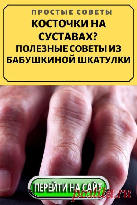 В лечении артрита и профилактике острых приступов болевого синдрома успешно применяют народную медицину. Выделяют несколько средств и методов лечения в домашних условиях: