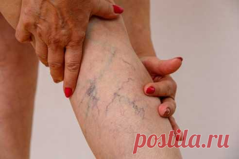 Из-за этих продуктов у вас возникнут тромбы