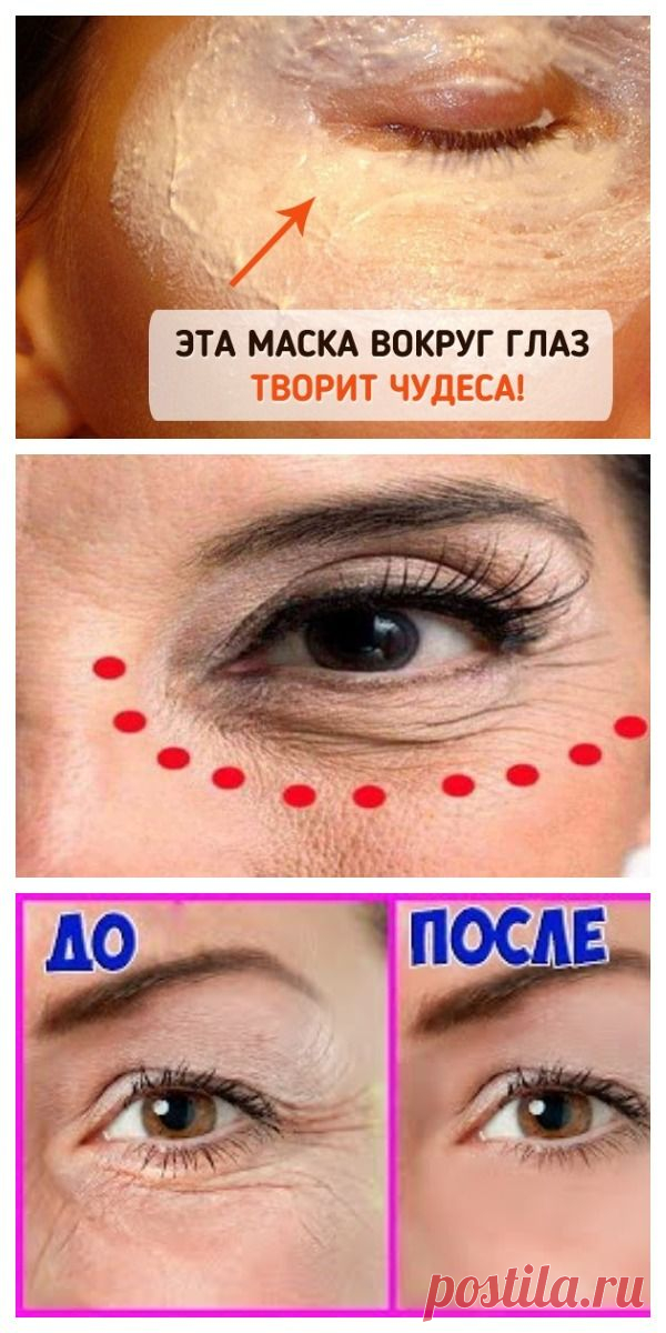 Стираем морщины и мешки вокруг глаз