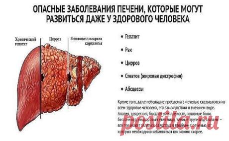 Если вас беспокоит печень