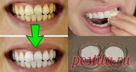 6 способов попрощаться с желтой улыбкой!