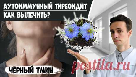 ЧЕРНЫЙ ТМИН против аутоиммунного тиреоидита (АИТ). Восстановление щитовидной железы. | НА ПУЛЬСЕ. Доктор Атабеков Игорь | Дзен