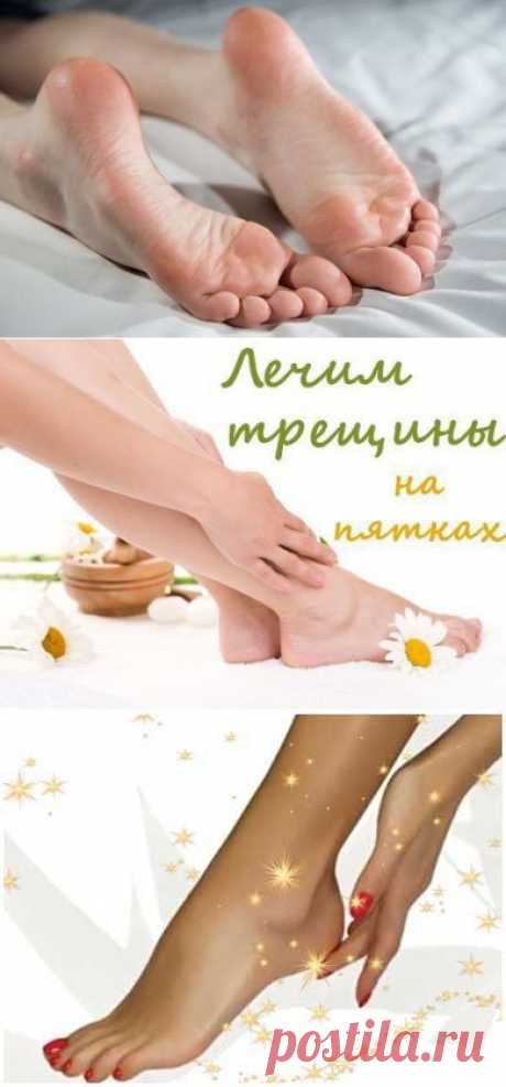 Пяточки как у младенца